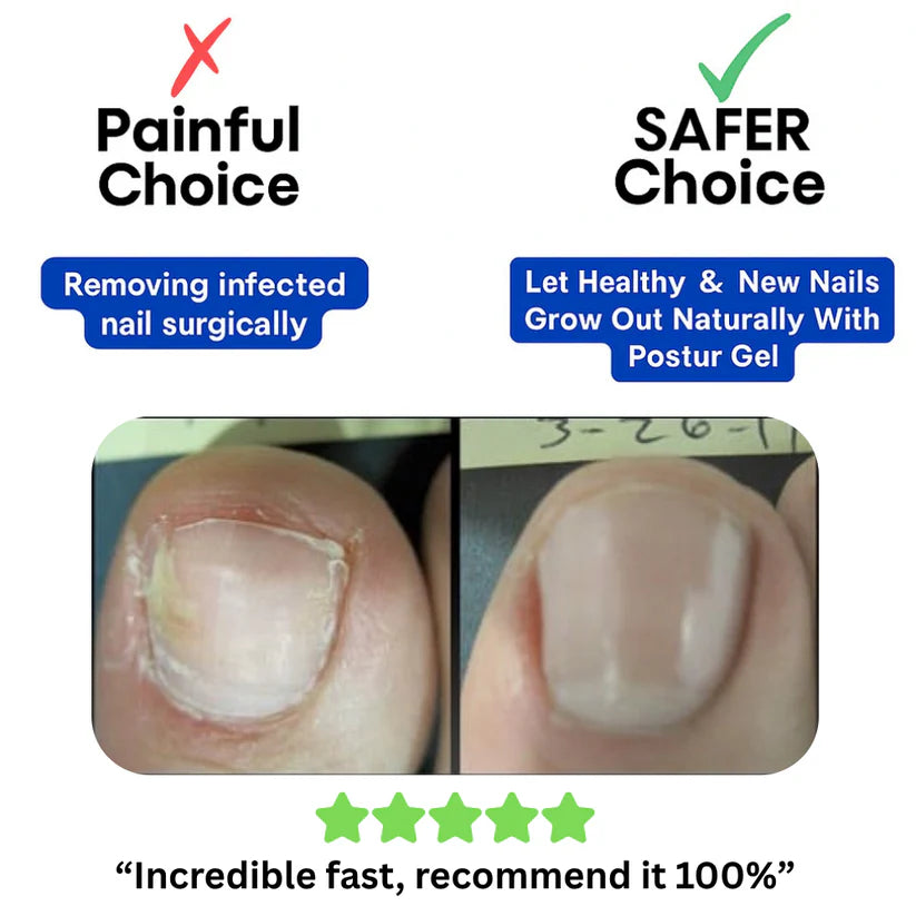 Fungal Nail Renewal Patches
