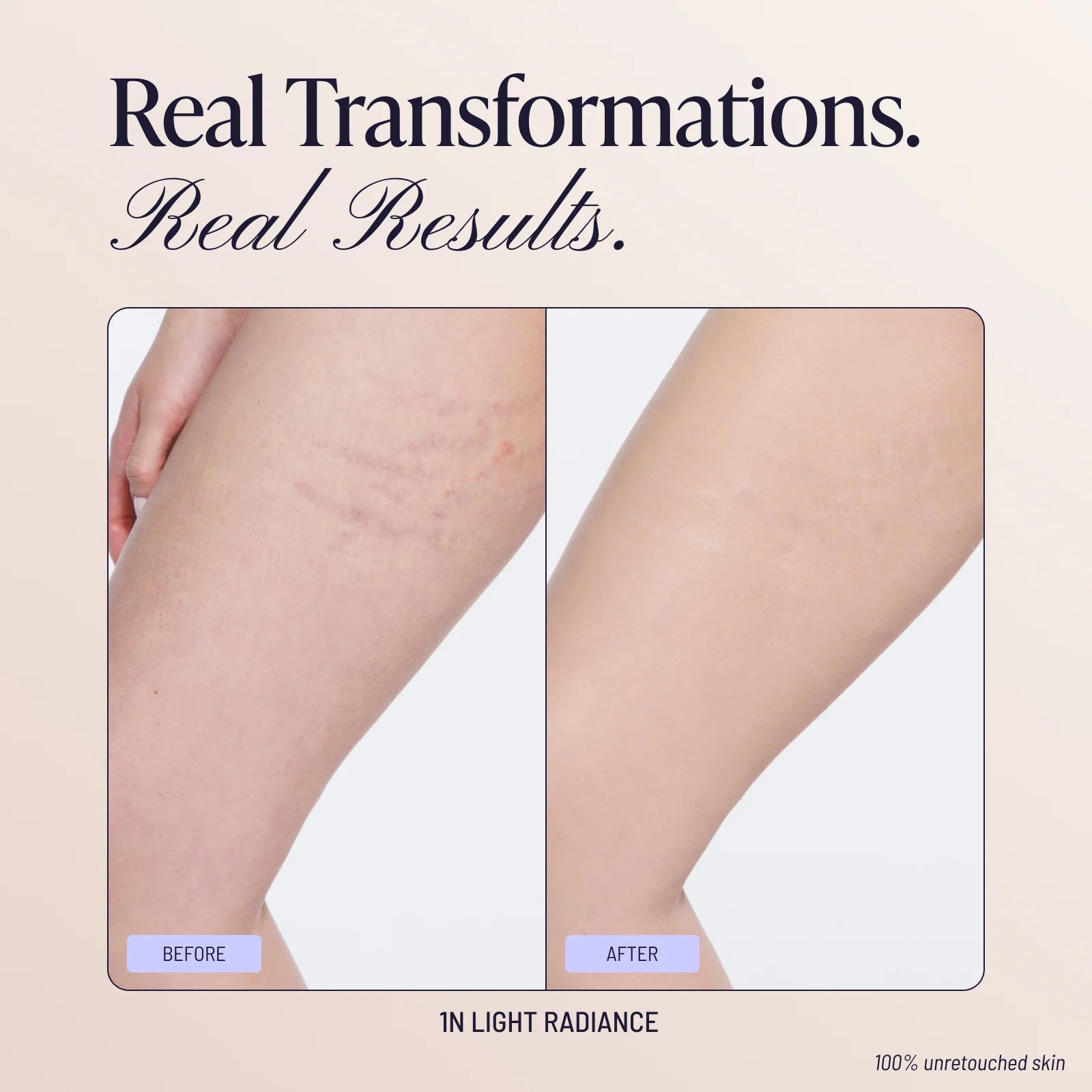 Body Coverage Perfector