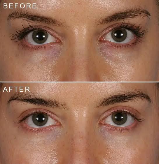 Vegan Collagen Eye Serum