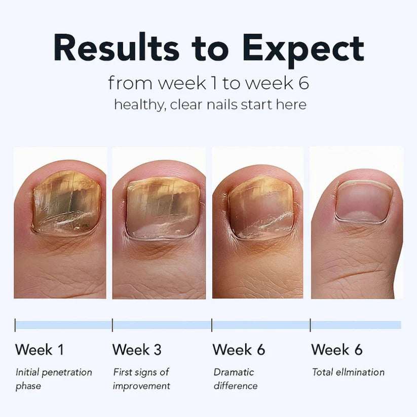 Fungal Nail Renewal Patches