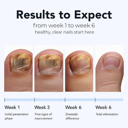 Fungal Nail Renewal Patches