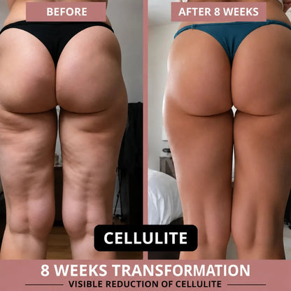 Sculpting Leggings for Weight Loss &amp; Cellulite Reduction