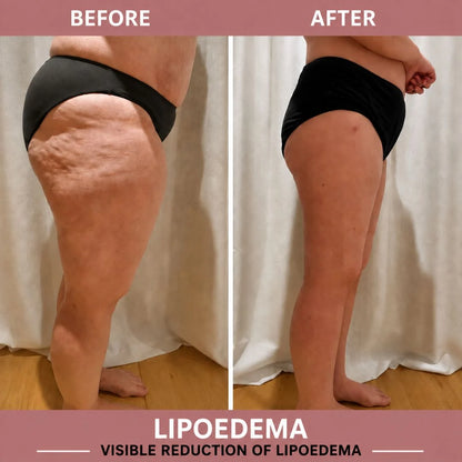 Sculpting Leggings for Weight Loss &amp; Cellulite Reduction
