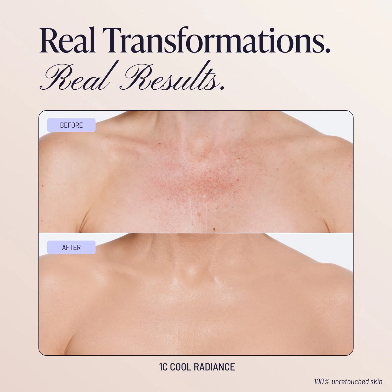 Body Coverage Perfector