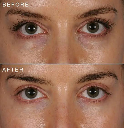 Vegan Collagen Eye Serum