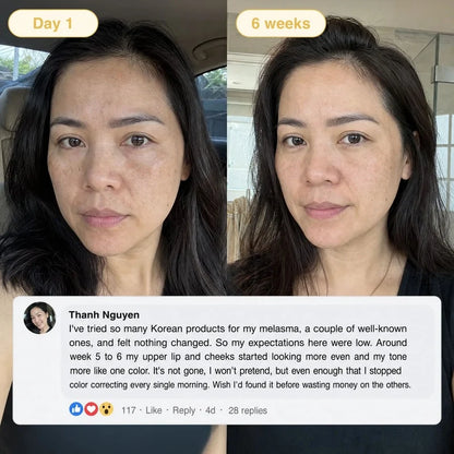 Turmeric &amp; Kojic Acid Overnight Mask