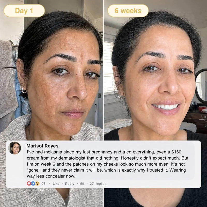 Turmeric &amp; Kojic Acid Overnight Mask